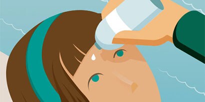 EEN LUST VOOR HET OOG! TIPS VOOR OOGLETSELS
