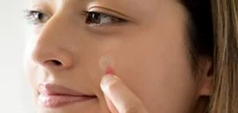 Nexcare™ Acne Patch
