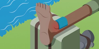 VERREKKINGEN & VERSTUIKINGEN? GEBRUIK GEWOON R.I.C.E
