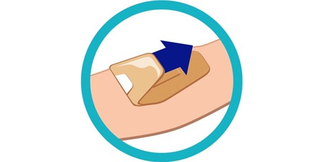 Diagram dat laat zien hoe Nexcare™ DUO-pleisters op de juiste manier worden verwijderd
